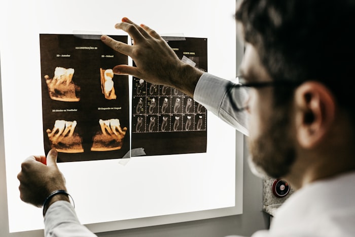 Clinician reviewing scans on a lightbox.